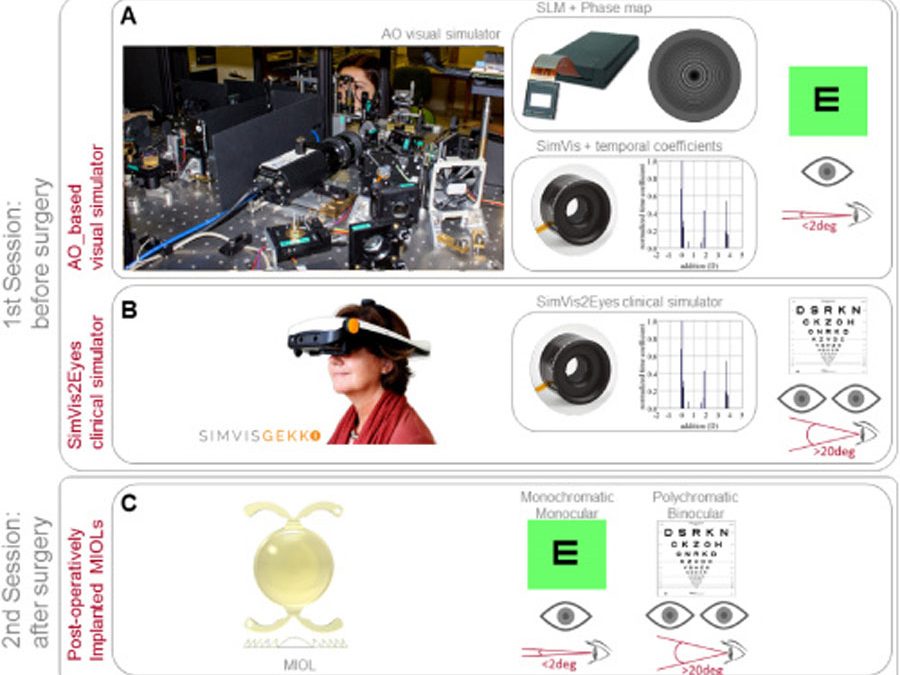 Pre-operative simulation of post-operative multifocal vision  (2019)
