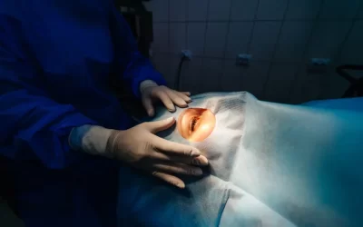 Cirugía Refractiva: Guía Completa