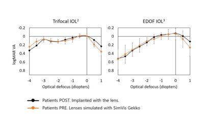 Binocular defocus curves with different multifocal IOLs