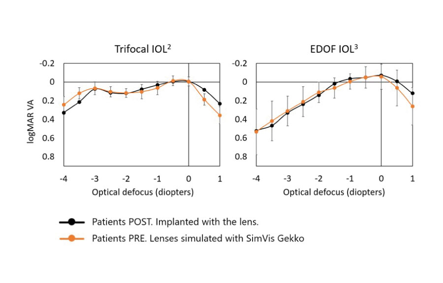 Binocular defocus curves with different multifocal IOLs