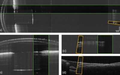 Optical beam scanner with reconfigurable non-mechanical control of beam position, angle, and focus for low-cost whole-eye OCT imaging (2023)