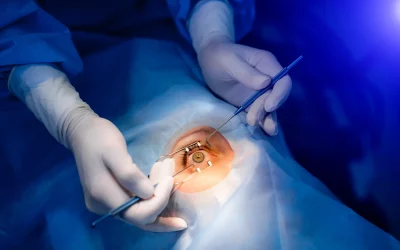 Enhancing expectation alignment in refractive cataract surgery