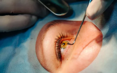 How to differentiate your cataract surgery clinic